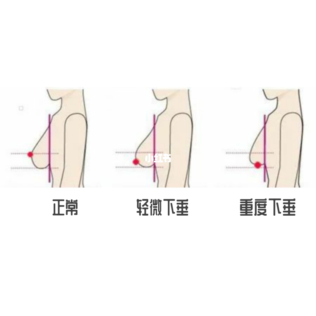 有没有丰胸外用产品？_丰胸产品评价_丰胸外用产品试用装