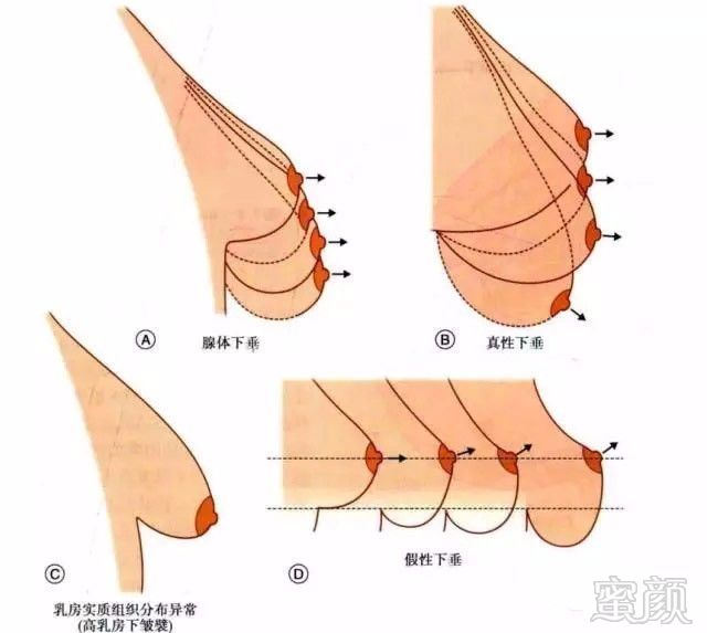 丰胸外用产品试用装_丰胸产品评价_有没有丰胸外用产品？