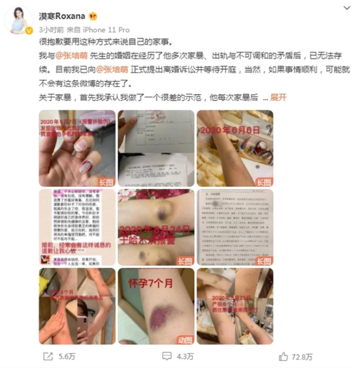 短跑名将张培萌殴打岳母被行拘，曾被妻子控诉家暴，现任清华大学助教