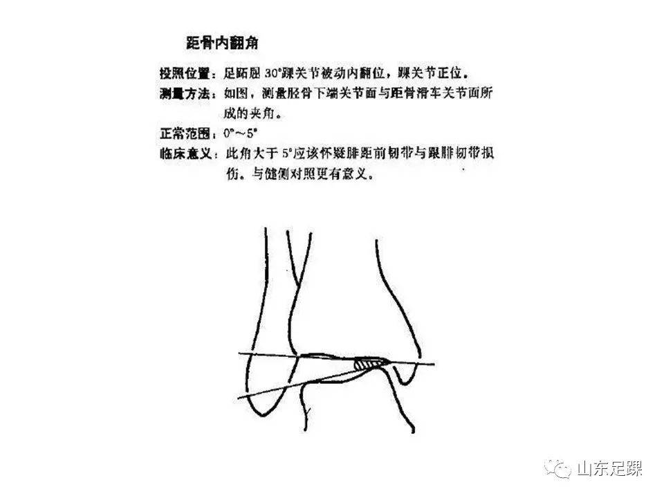 一文了解 | 踝关节影像学检查