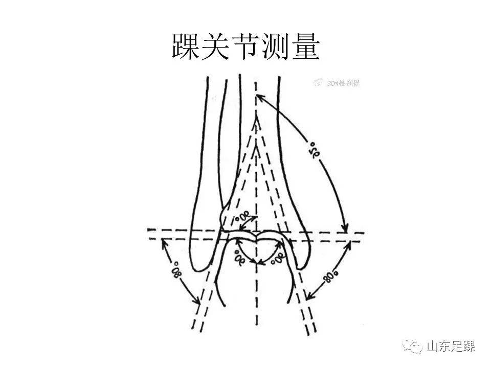 一文了解 | 踝关节影像学检查