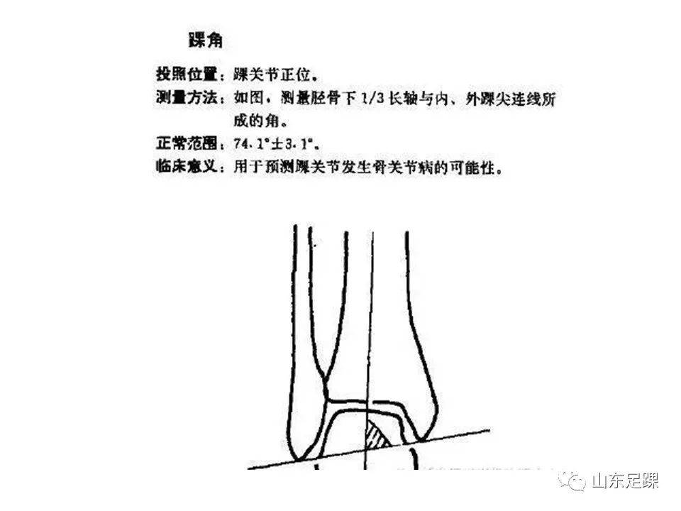 一文了解 | 踝关节影像学检查