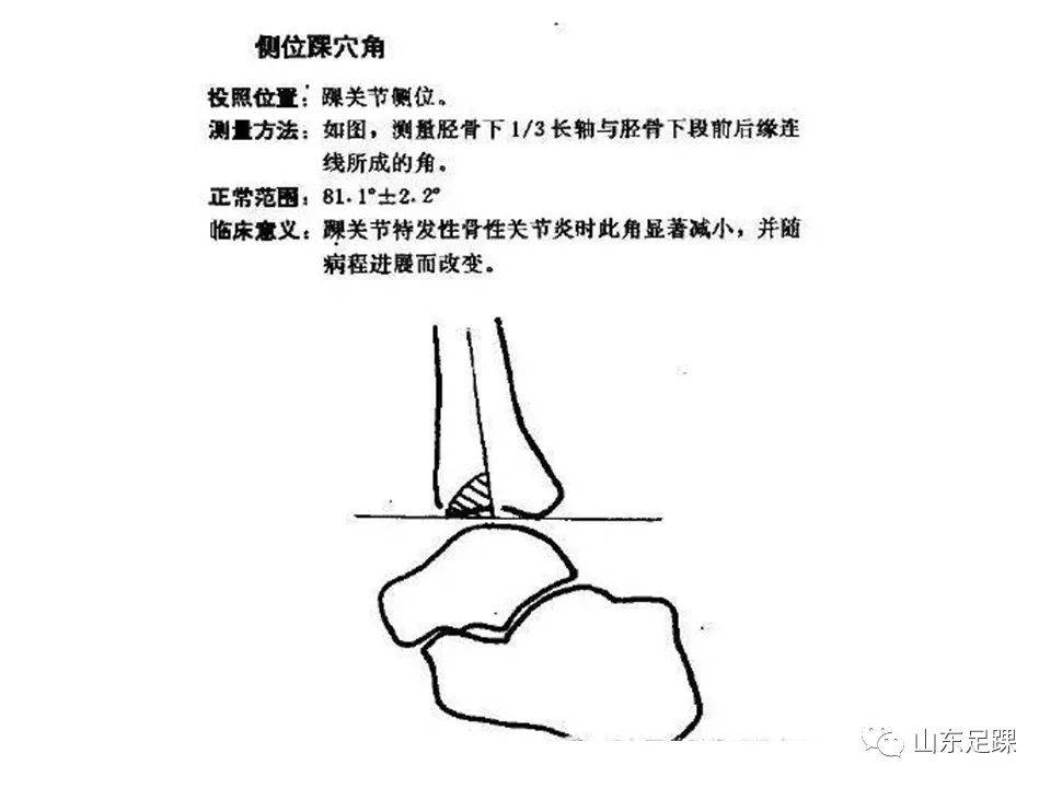 一文了解 | 踝关节影像学检查