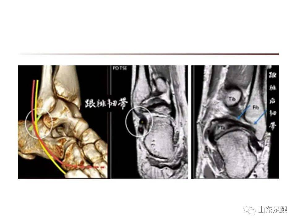 一文了解 | 踝关节影像学检查