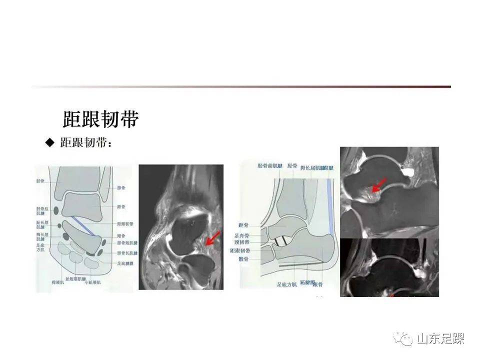 一文了解 | 踝关节影像学检查