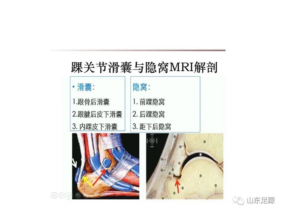 一文了解 | 踝关节影像学检查