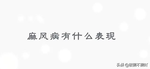 麻风病传染吗通过什么渠道传染呢 麻风病是什么病,具体的症状是什么