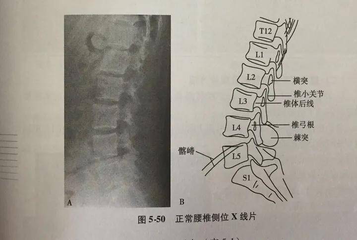 瑜伽，美体or伤病？