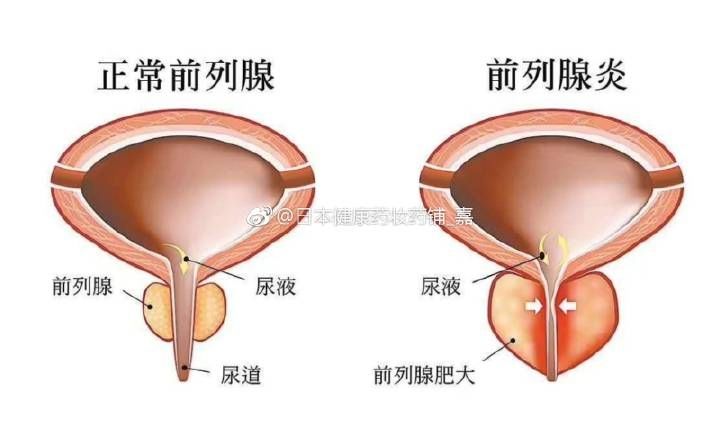 男性下面发痒是什么原因_男性尿道疼痛小便刺痛_男性