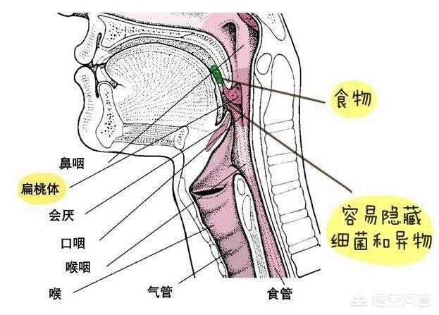 日常，出现3种表现，十有八九咽喉已“发炎”，具体指什么 近期嗓子疼或是此症