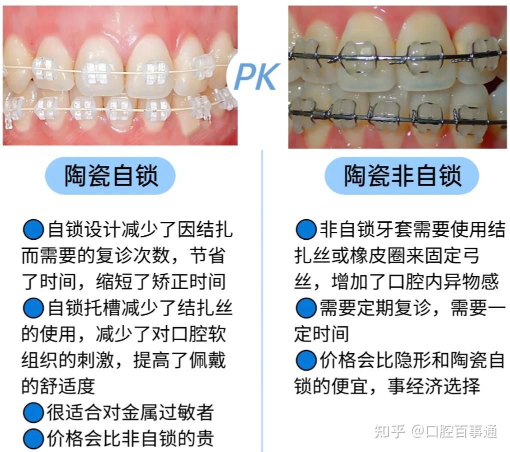 广州牙齿矫正有推荐嘛？