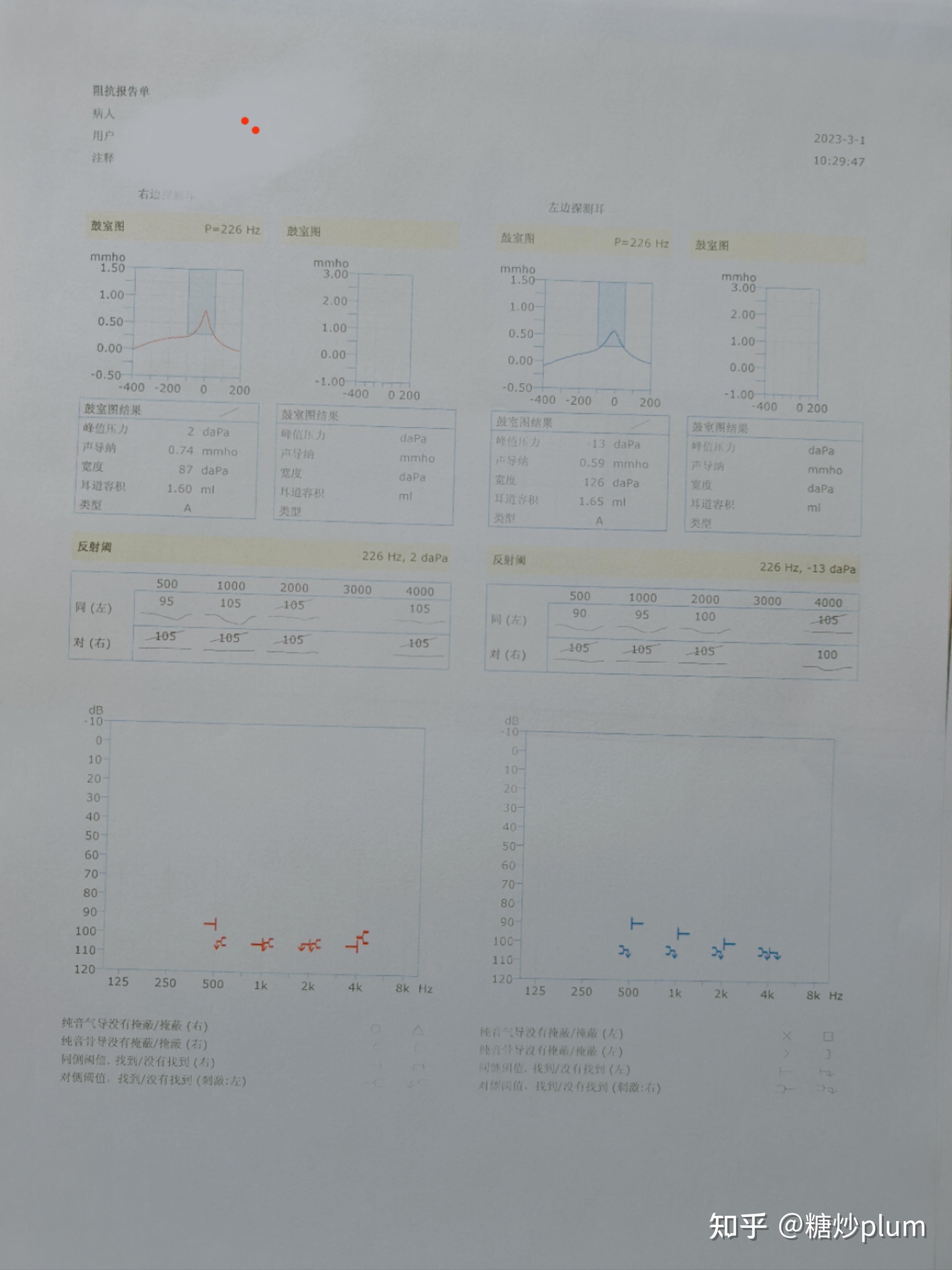 突发性耳聋可以治愈吗？