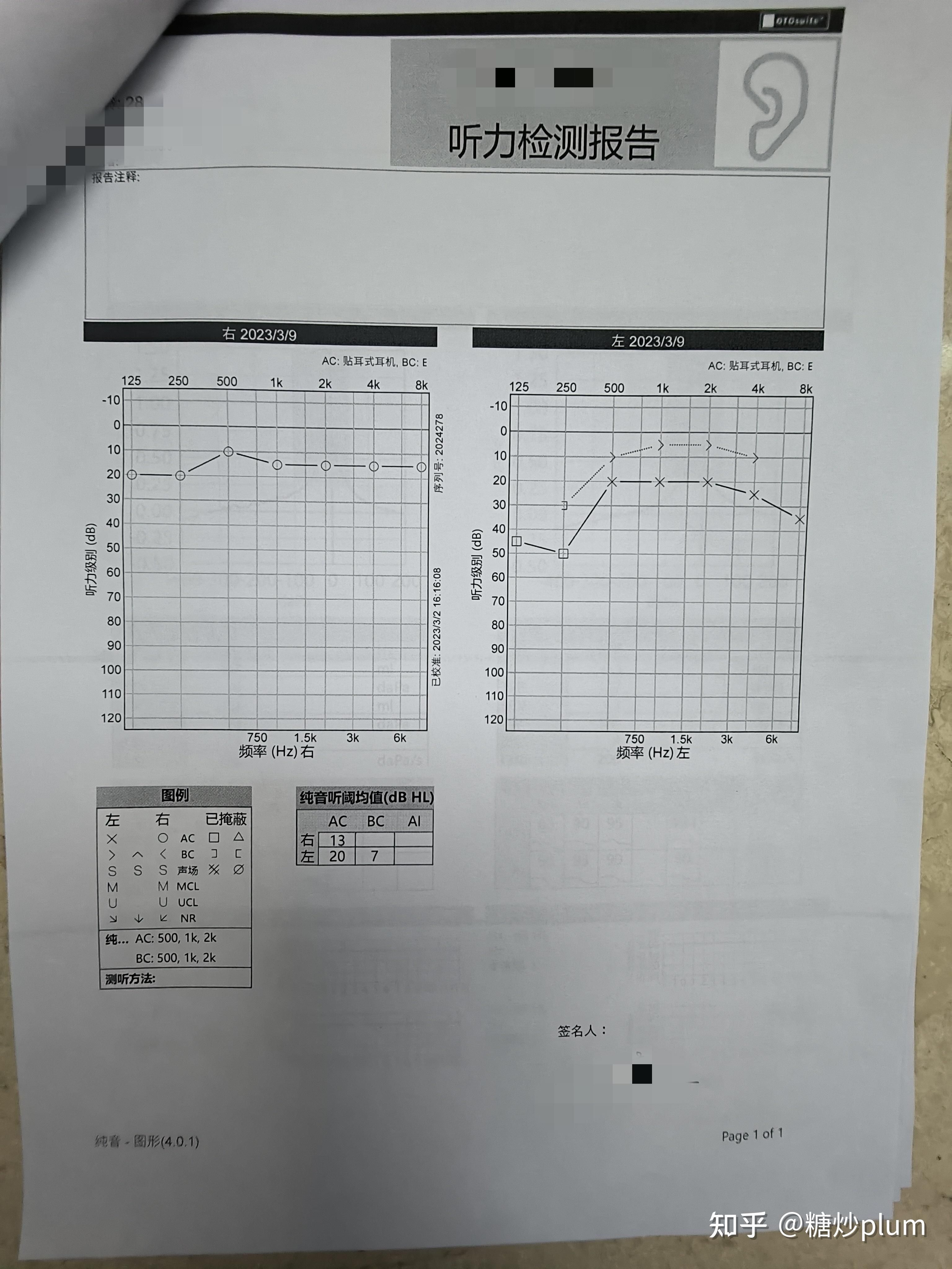 突发性耳聋可以治愈吗？