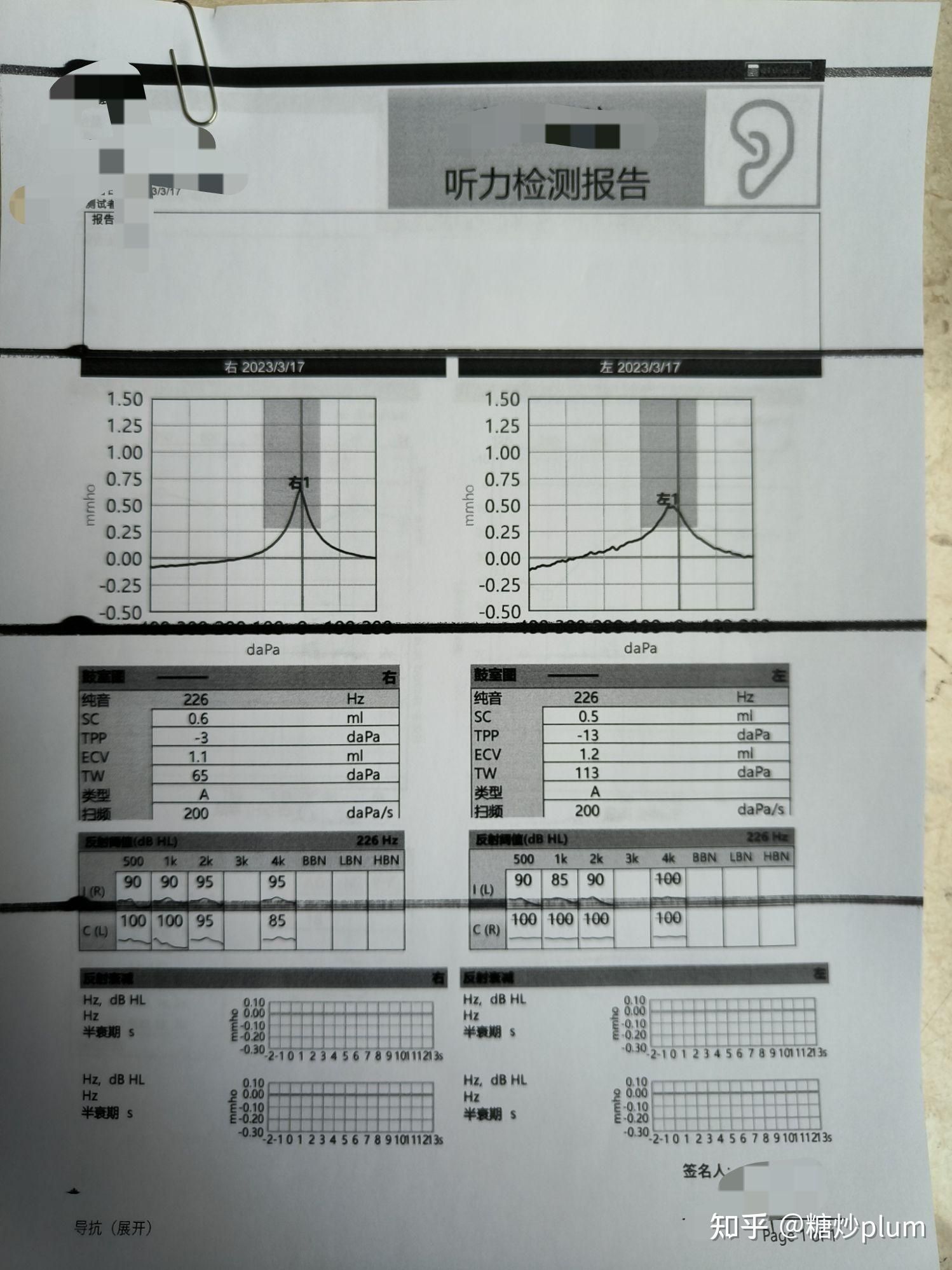 突发性耳聋可以治愈吗？