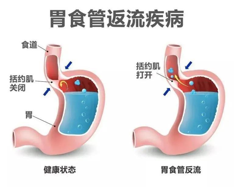 碱益生的功效作用_益生碱_碱益生可以调理碱性体质吗