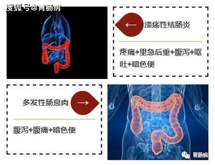 血便和便血的区别图片_血便_血便图片