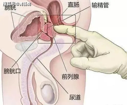 血便和便血的区别图片_血便_血便图片